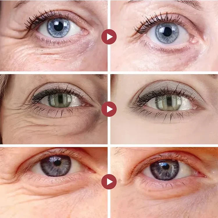 Collagen Eye Mask – Firming, Lifting & Anti-Wrinkle Under Eye Patches with Hyaluronic Acid