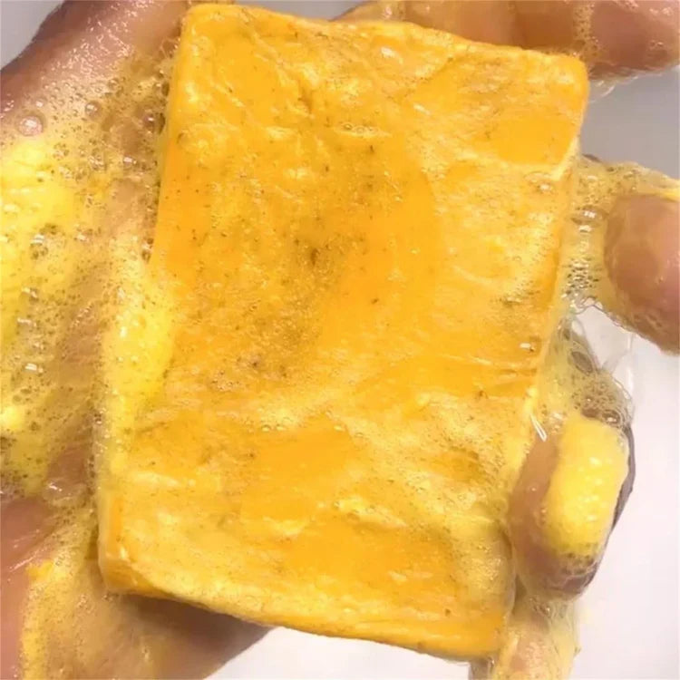 Lemon Turmeric Kojic Acid Soap – Deep Cleansing for Dark Spots & Acne