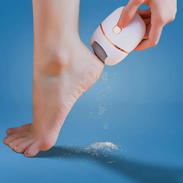 Electric Foot Callus Remover – Rechargeable Pedicure Tool for Smooth & Soft Feet
